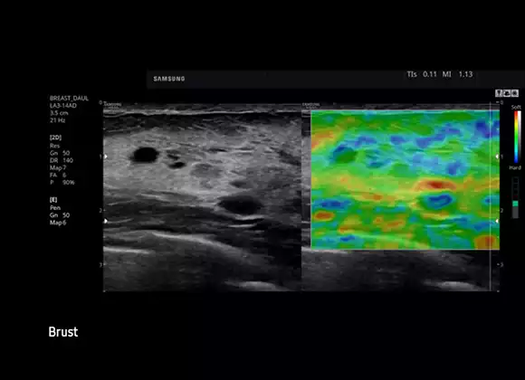 ElastoScan™