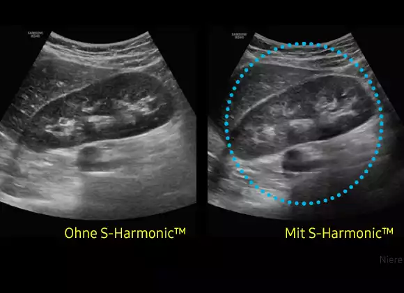 S-Harmonic™
