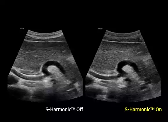 S-Harmonic™